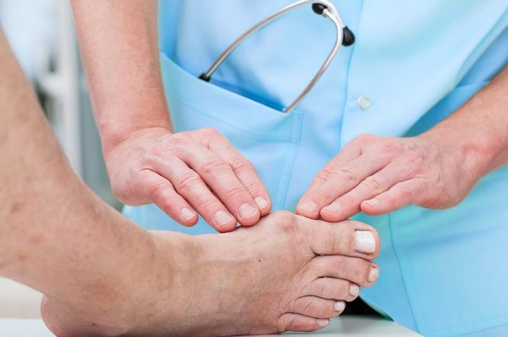 Подагра ног и жжение стопы