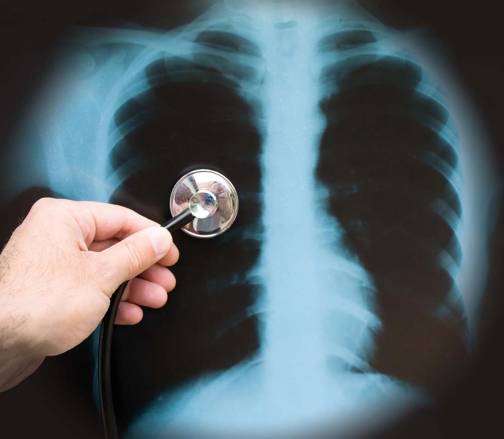 Обследование легких
