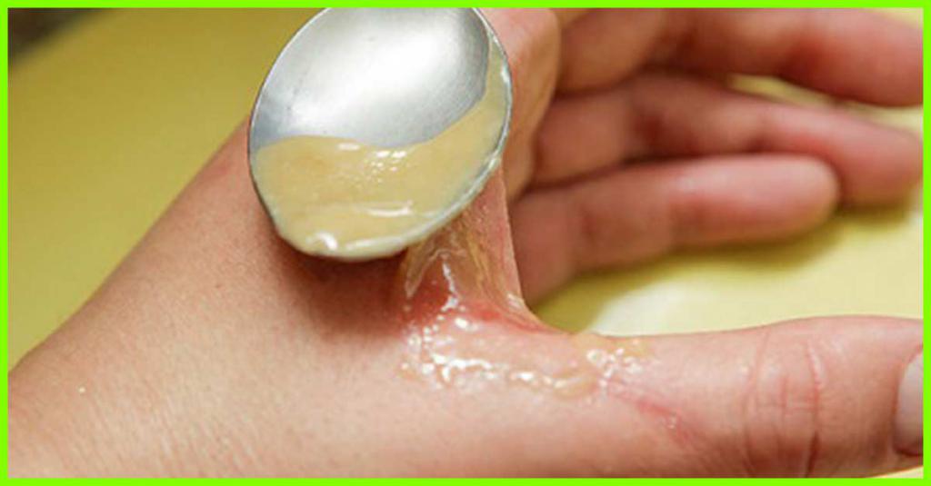 домашние средсва