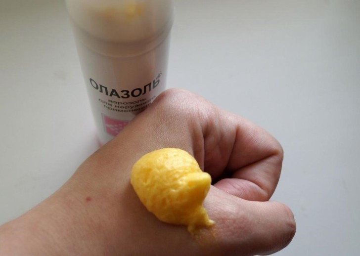 ожог руки утюгом что делать