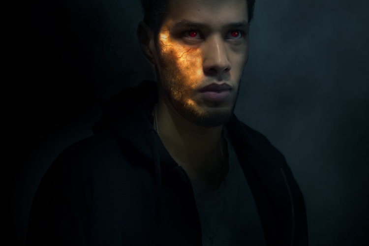 Ожог 3 степени на производстве