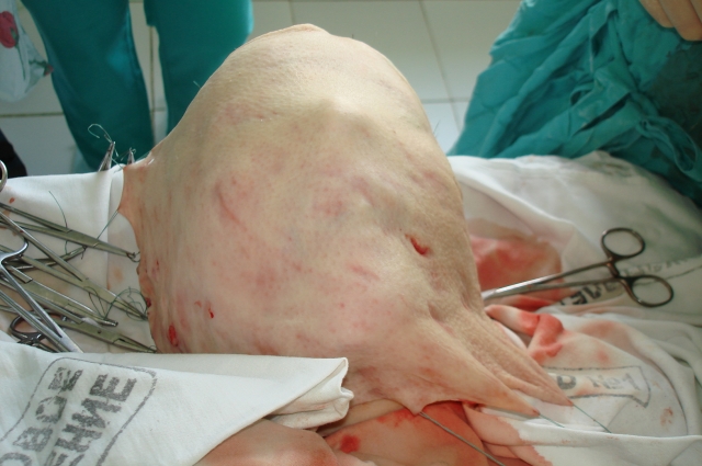 Краснодарский край ожог у мальчика