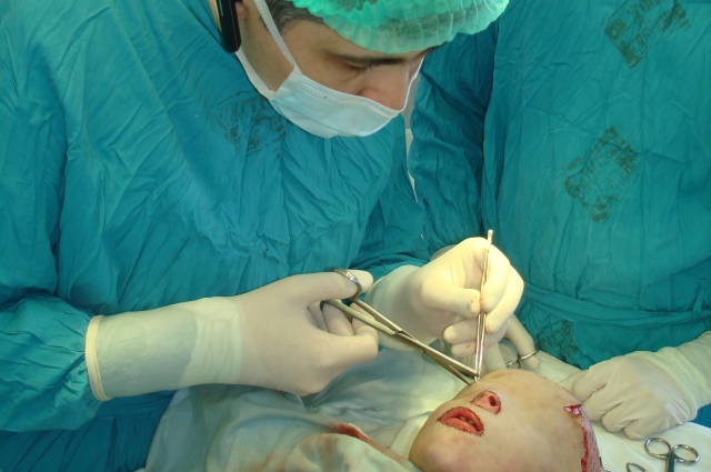 Краснодарский край ожог у мальчика