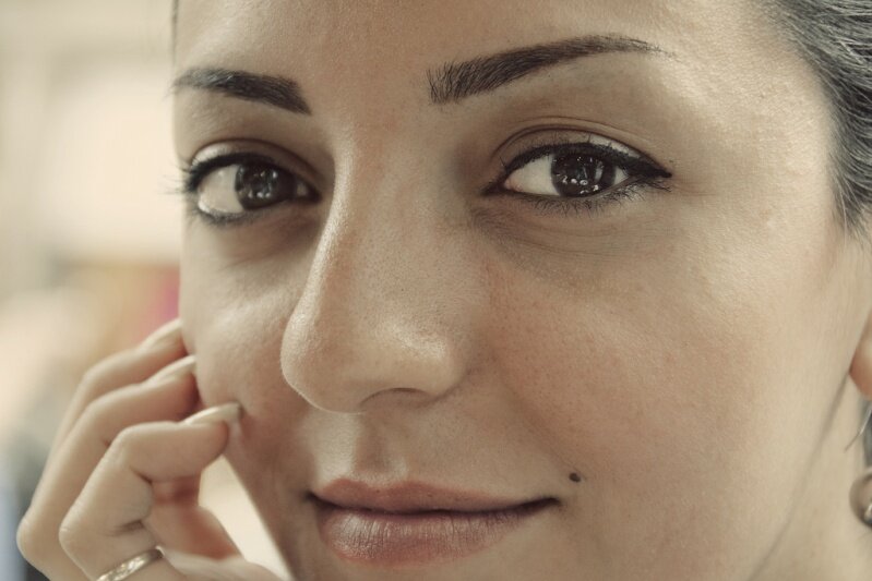 Появилось много родинок после ожога