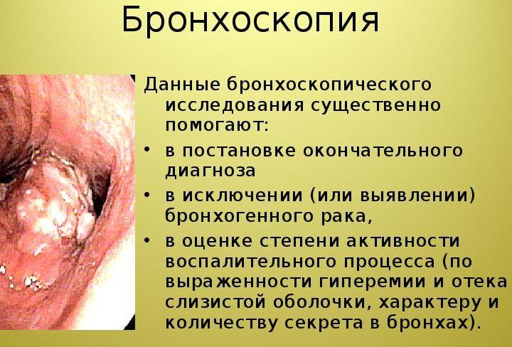 Бронхоскопия