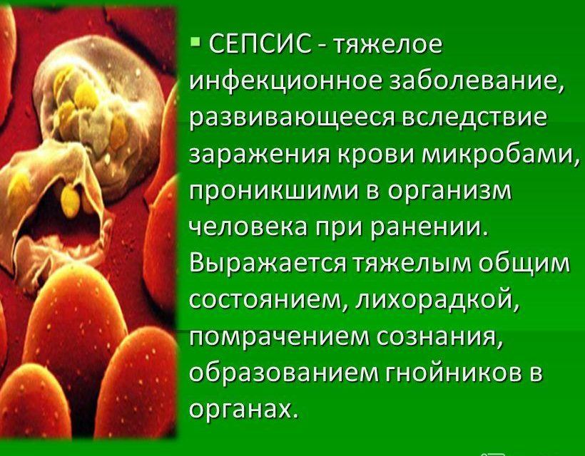 Сепсис является осложнением пневмонии