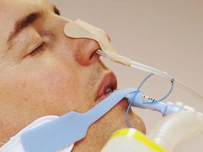 Установка назогастрального зонда для профилактики пневмонии