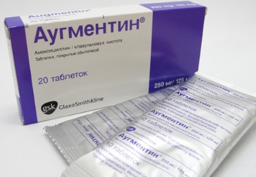 Лучшие антибиотики при отите у взрослого, ребенка. Таблетки, уколы, капли