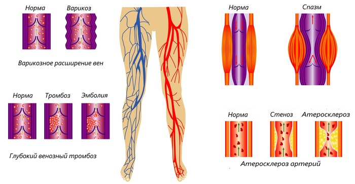 Болит кожа при прикосновении. Что это, на руке, ноге, голове, животе, спине, как будто обожжена. Диагностика и лечение