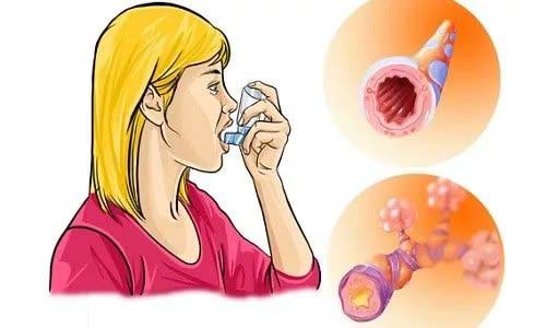 Если ребенок болен астмой Если ребенок болен астмой