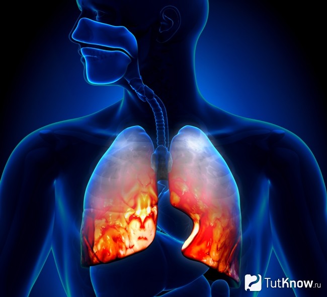 Чем опасен воспалительный процесс. Чем опасен воспалительный процесс.