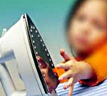 Ожоги у детей Ожоги у детей