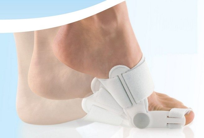 Использование шарнирного фиксатора Шарнирный фиксатор большого пальца