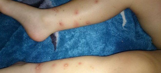 борщевик растение борщевик растение