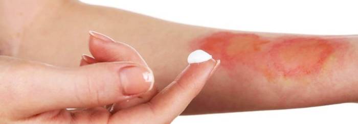 beauty-love.ru Спрей защита от солнечных ожогов