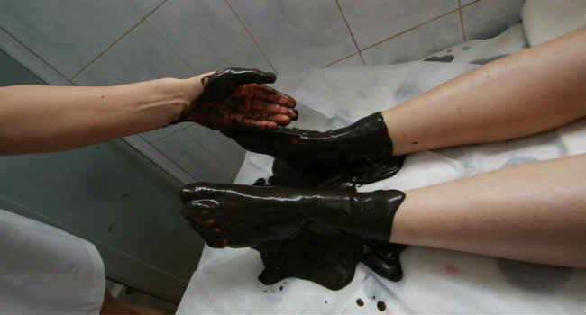 Грязелечение подагры