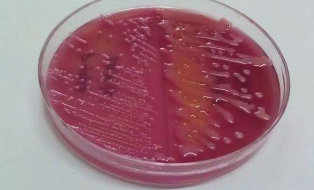 По версии микробиологов В кишечнике обнаружена клебсиелла, что это значит