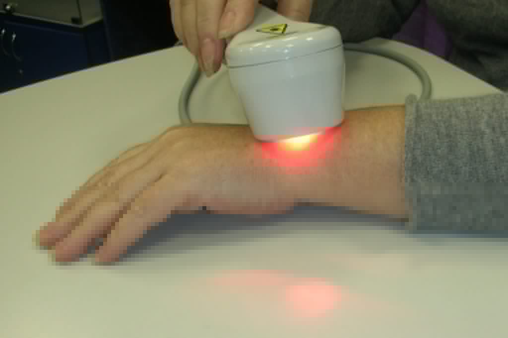 Лазерная терапия при подагре