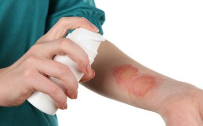 Пузырь после ожога чем лечить