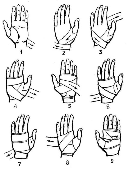 Как правильно перевязывать руку