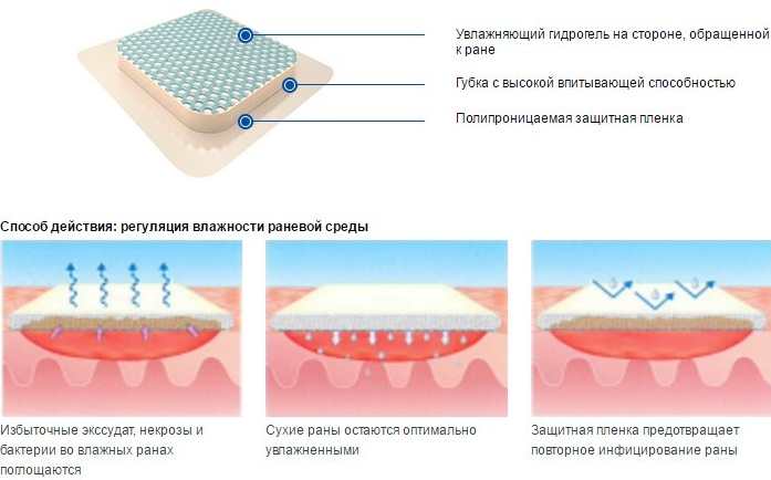 Пластыри от пролежней для лежачих больных. Названия, инструкция, цена, отзывы