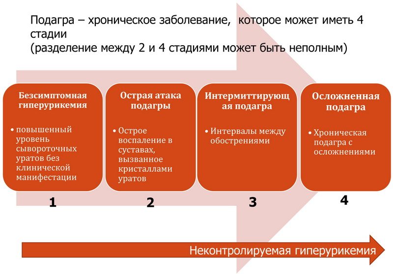 Подагра ног и жжение стопы