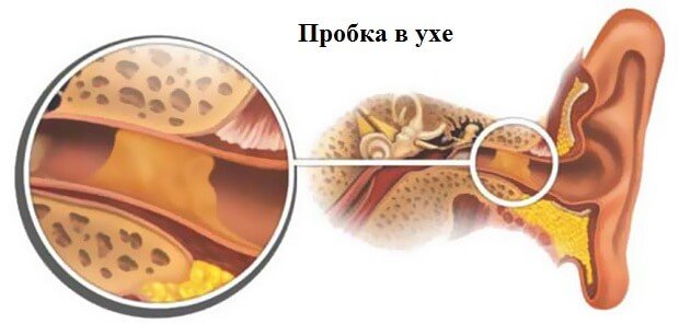 Серная пробка