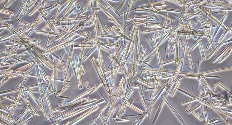 От чего возникает приступ От чего возникает приступ