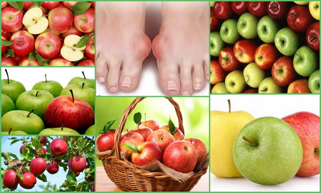 Яблоки при подагре польза или вред Яблоки при подагре польза или вред thumbnail